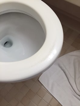 Toilet seat mildew stains
