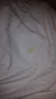 Stain on sheets