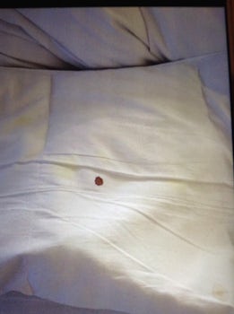 Blood on mattress