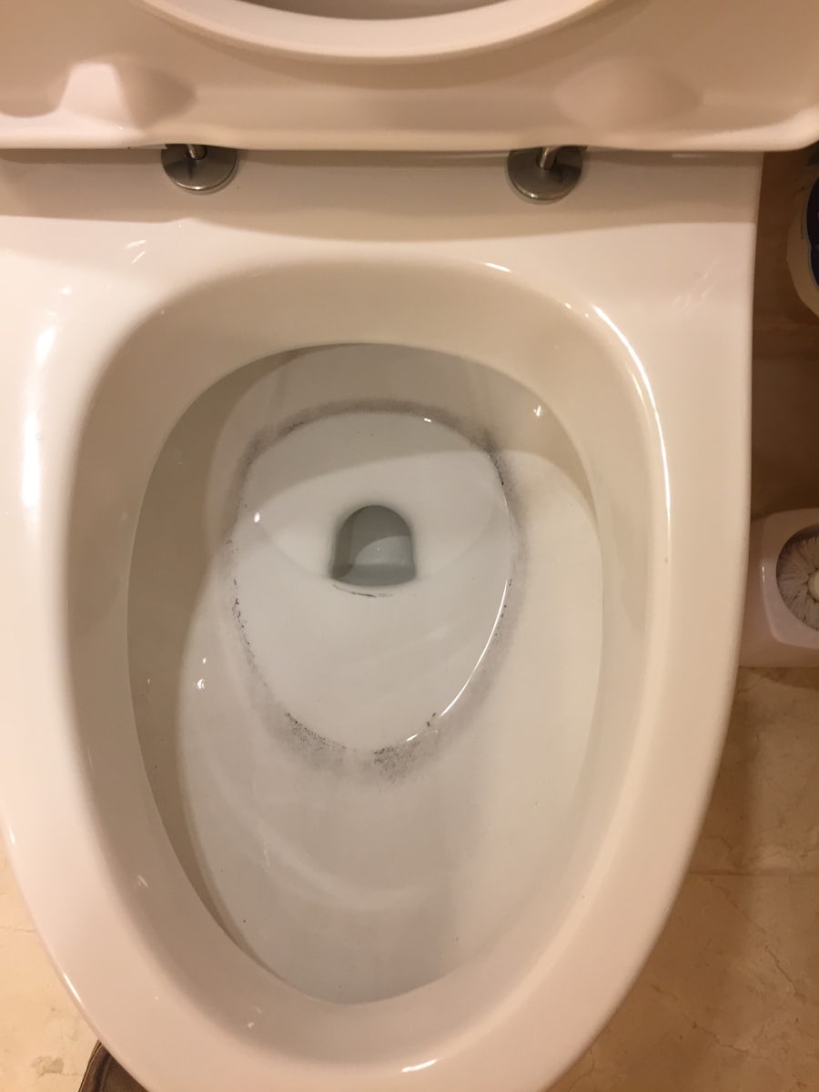 Toilet Ring that "nothing could be done"