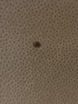 Bedbugs in our Stateroom!