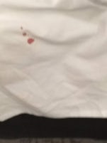 Bloody sheets on my bed