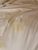 Stains on sheets in my Balcony Room 